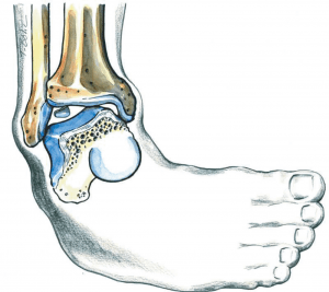 Χόνδρινες βλάβες ποδοκνημικής