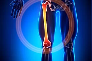 Ρομποτική Μονοδιαμερισματική Αρθροπλαστική Γόνατος